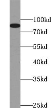 HCN3 Rabbit Polyclonal Antibody