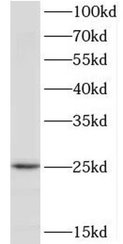 TPD52L1 Rabbit Polyclonal Antibody
