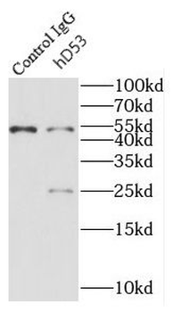 TPD52L1 Rabbit Polyclonal Antibody