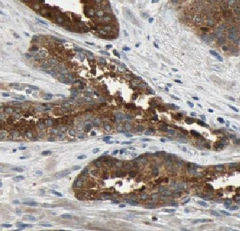 TPD52L1 Rabbit Polyclonal Antibody