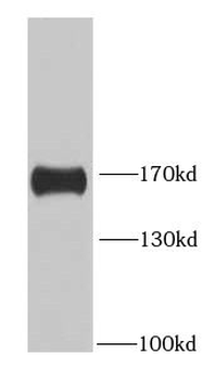 HDAC6 Rabbit Polyclonal Antibody