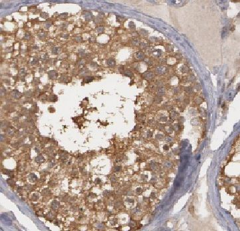 HDAC6 Rabbit Polyclonal Antibody