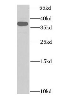 HDGF Rabbit Polyclonal Antibody