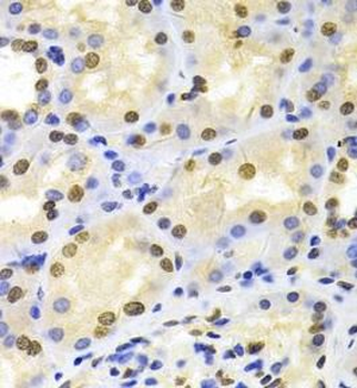 HDGF Rabbit Polyclonal Antibody