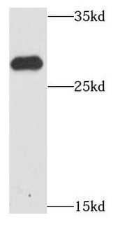 HDGFL3 Rabbit Polyclonal Antibody