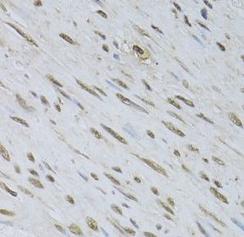 HDGFL3 Rabbit Polyclonal Antibody