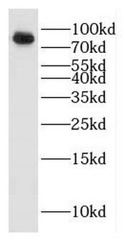 HECTD2 Antibody