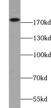 ERBB2 Rabbit Polyclonal Antibody