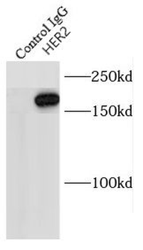 ERBB2 Rabbit Polyclonal Antibody