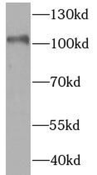 HK1 Rabbit Polyclonal Antibody
