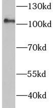 HK2 Rabbit Polyclonal Antibody