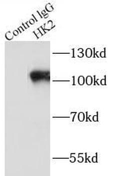 HK2 Rabbit Polyclonal Antibody