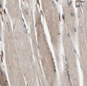 HK2 Rabbit Polyclonal Antibody