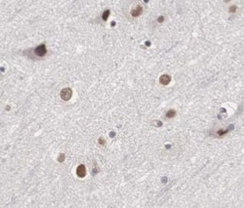 HEY1 Rabbit Polyclonal Antibody