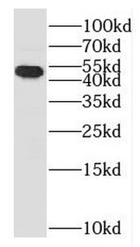 HGD Rabbit Polyclonal Antibody