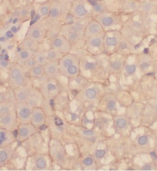 HGD Rabbit Polyclonal Antibody