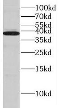 HIBCH Rabbit Polyclonal Antibody