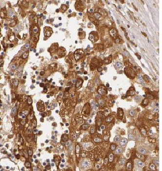 HIBCH Rabbit Polyclonal Antibody