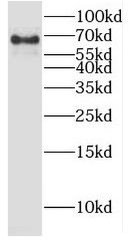 HIC1 Rabbit Polyclonal Antibody