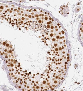 HIC1 Rabbit Polyclonal Antibody