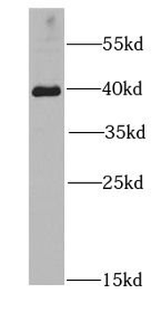 HIF1AN Rabbit Polyclonal Antibody