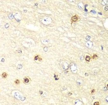 HIF1AN Rabbit Polyclonal Antibody