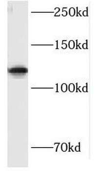 HIP1R Rabbit Polyclonal Antibody