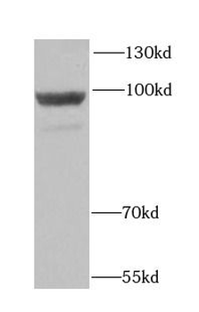 HK3 Rabbit Polyclonal Antibody