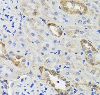 HK3 Rabbit Polyclonal Antibody