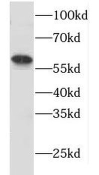 HLA DMA Rabbit Polyclonal Antibody