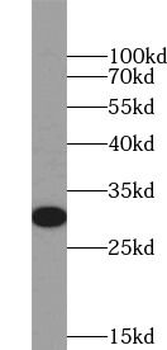 HLA DQB2 Rabbit Polyclonal Antibody