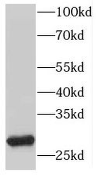 HLA DRB1 Rabbit Polyclonal Antibody