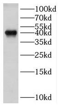 HLA-E Antibody