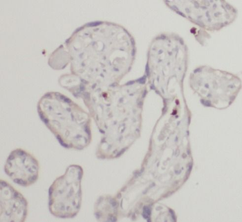 HLA F Rabbit Polyclonal Antibody