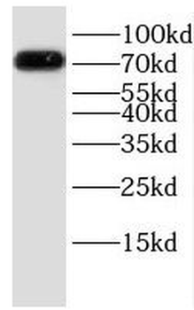 HLCS Rabbit Polyclonal Antibody