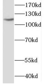 HLTF Rabbit Polyclonal Antibody
