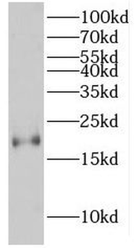 HMGA2 Rabbit Polyclonal Antibody