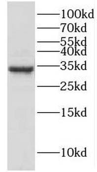 HMGB2 Rabbit Polyclonal Antibody