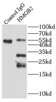 HMGB2 Rabbit Polyclonal Antibody