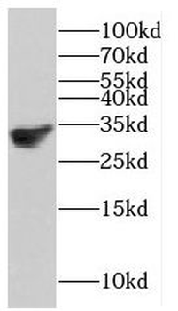 HMGB2 Rabbit Polyclonal Antibody