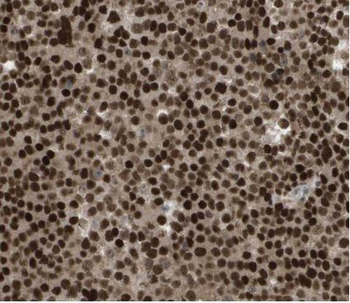 HMGB2 Rabbit Polyclonal Antibody