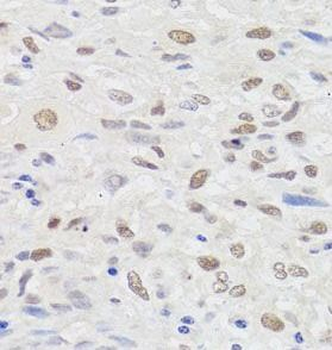 HMGN1 Rabbit Polyclonal Antibody
