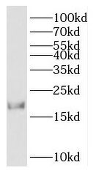 HMGN2 Rabbit Polyclonal Antibody