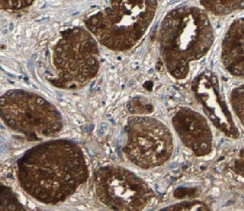 HMGN2 Rabbit Polyclonal Antibody