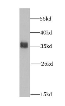 HNRNPA0 Rabbit Polyclonal Antibody