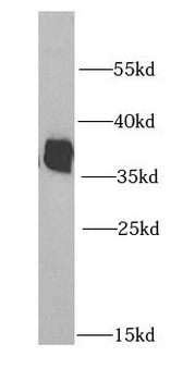 HNRNPA2B1 Rabbit Polyclonal Antibody