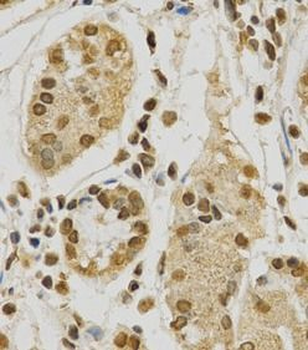 HNRNPA2B1 Rabbit Polyclonal Antibody