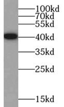 HNRNPA3 Rabbit Polyclonal Antibody