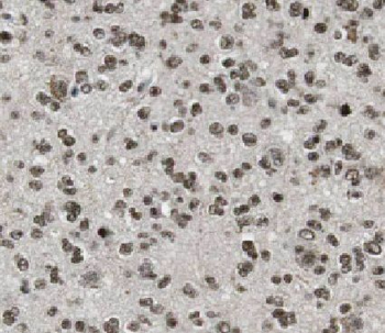 HNRNPC Rabbit Polyclonal Antibody