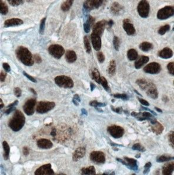 HNRNPH1 Rabbit Polyclonal Antibody